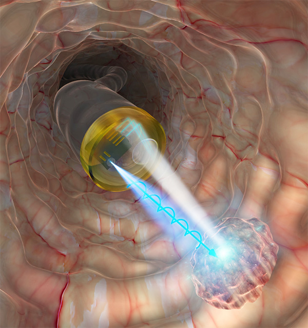 Figure 1. In vivo cancer diagnosis