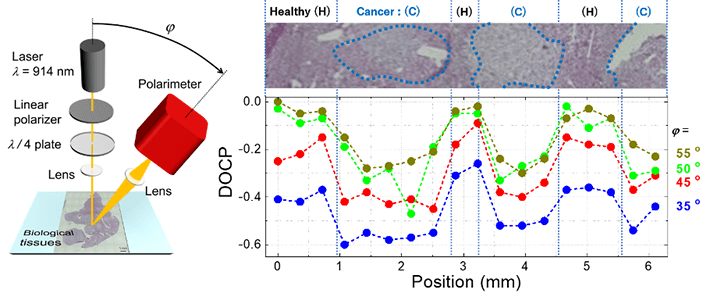 Figure 2.Experimental demonstration of the cancer diagnosis technique in biological tissue