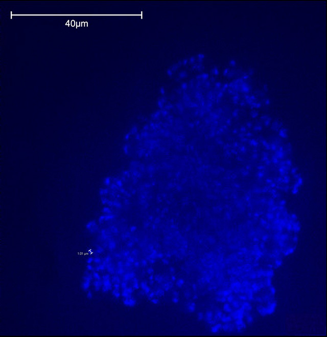 Figure 1 A microscopic picture of a methanogen A 100x100 µm field of view of an aggregate of methane-producing microorganisms. Credit: Paula Prondzinsky