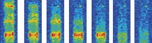 Hirai's research group has used MRI to depict the displacement of water...