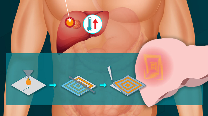 Turning the Heat on: A Flexible Device for Localized Heat Treatment of Living Tissues