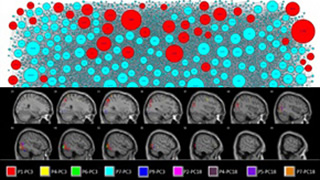 Markov-inverse-F measure: a network connectivity approach using MVPA of fMRI