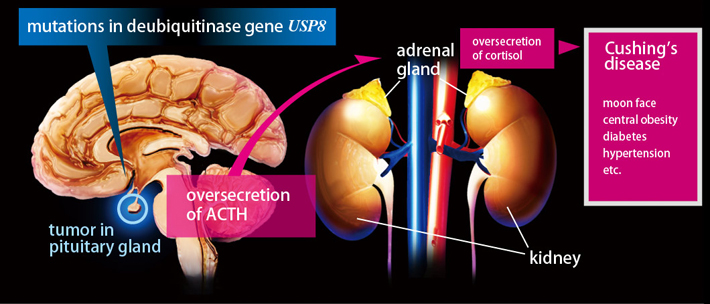 Pathogenesis of Cushing's disease