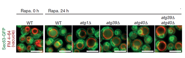 Fluorescence microscopy images of yeast cells. Left to right: untreated wild type cells (Rapa. 0 h); cells treated with rapamycin for 24 hours (Rapa. 24 h) - wild type, atg1 mutant, atg39 mutant, atg40 mutant and atg39 atg40 double mutant. The researchers used the ER membrane protein Sec63 fused with green fluorescent protein (GFP) to monitor autophagy of the ER. Autophagic degradation of Sec63–GFP yielded vacuolar protease-resistant GFP fragments, which increased GFP fluorescence within the vacuole (red circles).