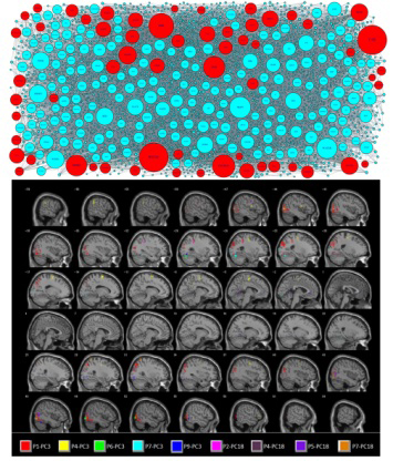 Example of conceptual association overlaid on brain images.