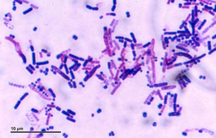 Figure 2 Bacteria and other living things are composed of a complex set of chemicals. As alien life may be fundamentally different from Earth-life, it may be difficult for future space probes to tell if complex chemical mixtures are derived from living or non-living processes. Credit: Josef Reischig.