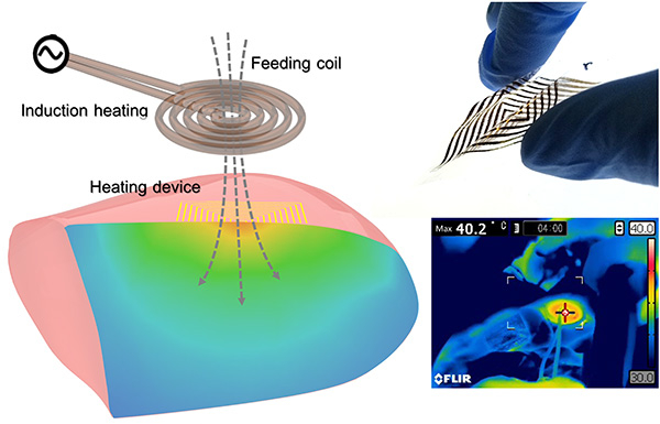 Electronic circuit using proprietary wiring transcription enabled the development of a flexible 7-µm power generation device made of polymeric thin film. Local heating of living tissue was accomplished using induction heating through wireless power transfer. (Adapted from Saito et al., 2021)
