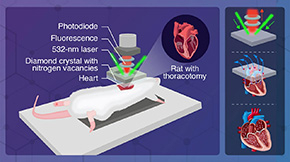 Measuring Currents in the Heart at Millimeter Resolution with a Diamond Quantum Sensor