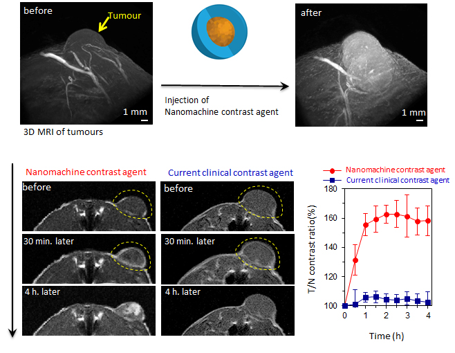 The nanomachine contrast agent makes possible the detection of cancer with a higher contrast than current contrast agents. Further, the regions of higher malignancy inside the tumor mass-produce more intense signals, providing additional information about the structure and the characteristics inside the tumor mass.