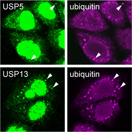 Evidence of USP5, USP13 and ubiquitin chains inside stress granules.