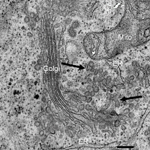 Image of a cell's interior without USP8
