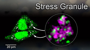 Goodbye 'stress granules': Study expands possibilities for treating neurological diseases