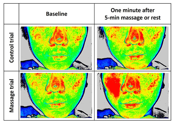 Figure 1. Visualization of changes in skin blood flow