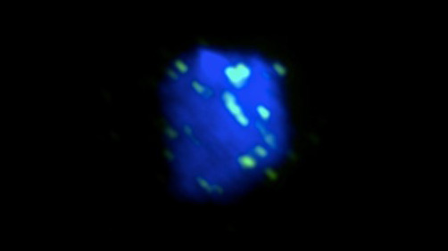 Figure 1. A yeast nucleus was irradiated with UV and imaged by fluorescent microscopy. Rad51 (green), the central protein in HR, localizes to DNA (blue) in order to repair the UV-induced damage.