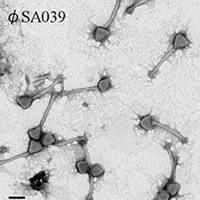 Figure caption: Electron microscope images of bacteriophages that could help prevent bovine mastitis. The scale bar is 100 nm, and arrows indicate contracted sheaths.