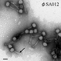 Figure caption: Electron microscope images of bacteriophages that could help prevent bovine mastitis. The scale bar is 100 nm, and arrows indicate contracted sheaths.