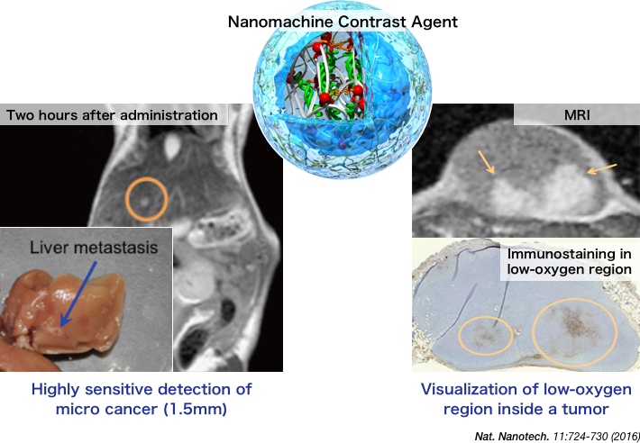 The nanomachine contrast agent enables detection of cancers at a higher contrast than current MRI contrast agents do. It also improves diagnostic information by detecting the signal showing the cancer in white in low-oxygen and low-pH regions, which are considered to have a high grade of malignancy.
