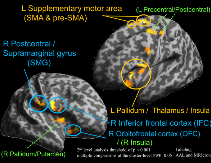 fMRI of an individual wearing a power support robot. Images show the difference in brain activity when the wearer feels and does not feel that the robot moves according to their intention.