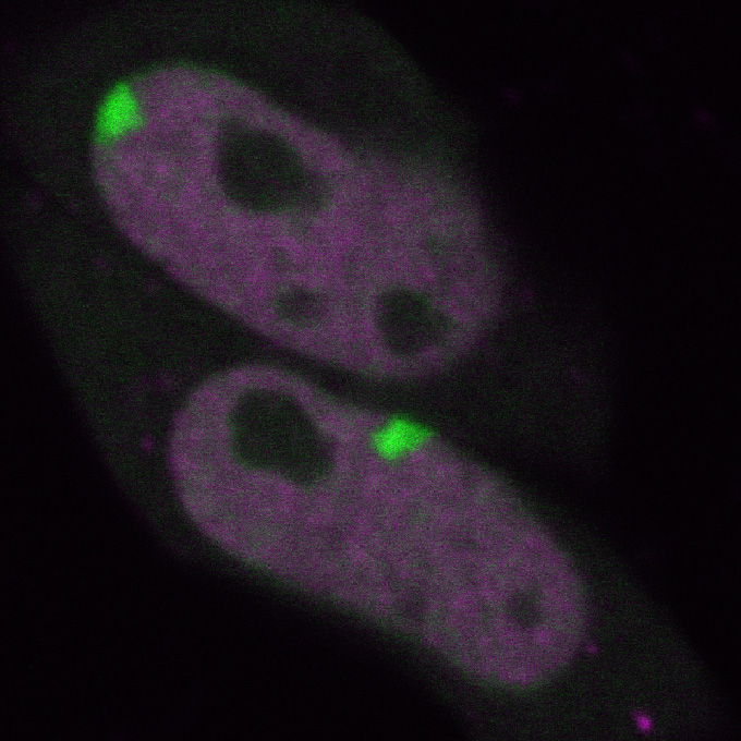 Observing histone modification in living cells using a fluorescence microscope