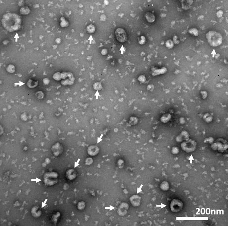 Electron micrograph of exosomes
