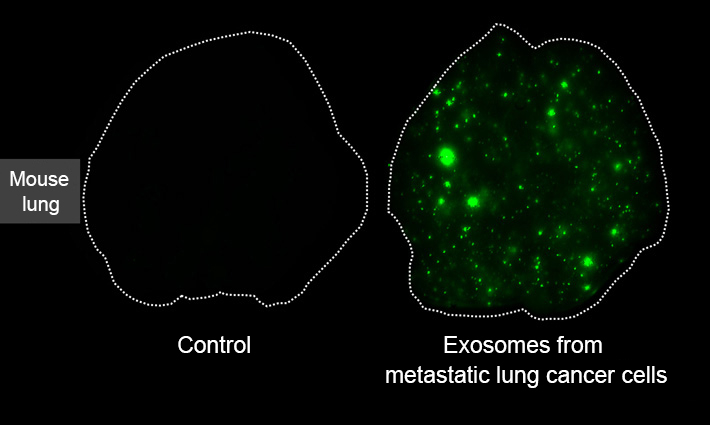 Exosomes reach the future site of metastasis before cancer cells and change cells at the site, making it easier for cancer cells to metastasize
