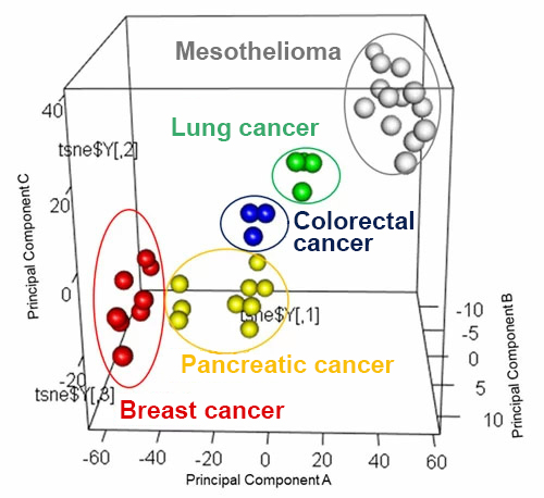 Through proteomics analysis of exosomes in blood, we can identify not only the presence of cancer, but also the type of cancer. Axes values denote relative difference in composition, with points further away from the origin indicating greater difference.