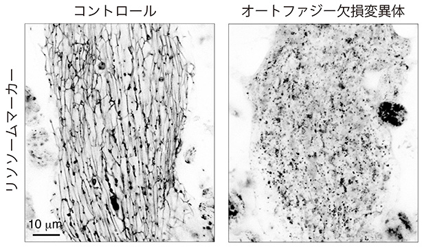 図2. 管状リソソームネットワークの形成はオートファジーに依存している