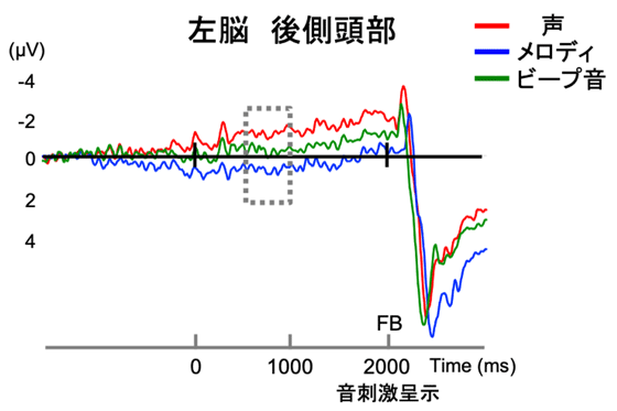 図1. 左脳後側頭部のSPNの平均波形