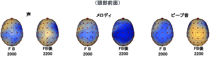 図4. 頭皮状電位分布図