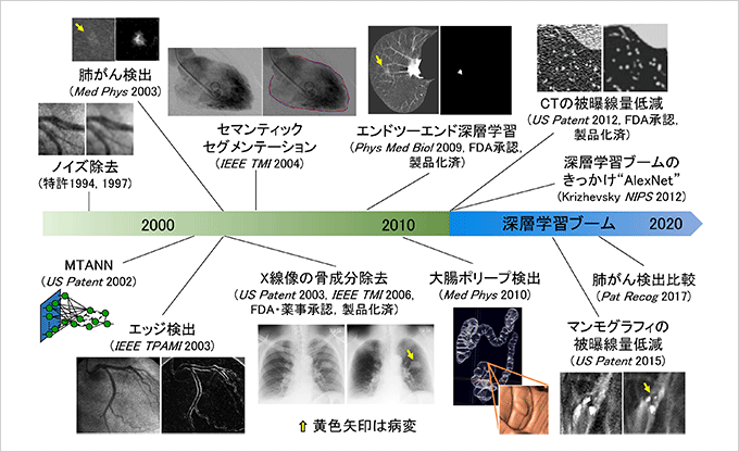 鈴木教授らによる独自の深層学習による医療AIの研究開発と実用化