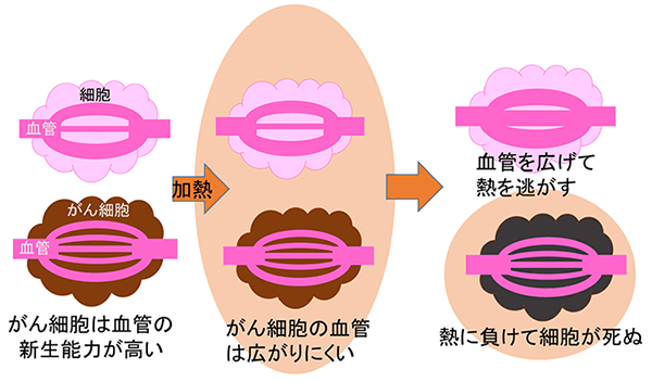 温熱療法の仕組み