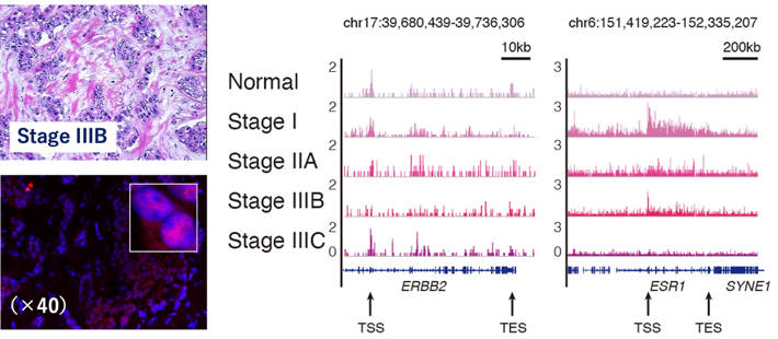 ChIL-seqによる乳がん組織のプロファイリング：ステージIIBの乳がん組織切片（左上、Origene社より購入）、RNA Polymerase II（赤）の切片上の局在（左下画像）、およびゲノム上のRNA Polymerase IIの局在（右側グラフ；代表的な乳がんマーカー遺伝子周囲）を示した。