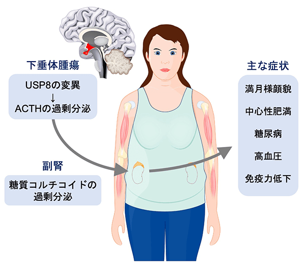 図1 クッシング病の徴候と症状