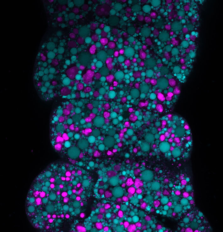 幼虫最終期の脂肪体内に見られる肥大したオートリソソーム（マゼンタ）と脂肪滴（シアン）