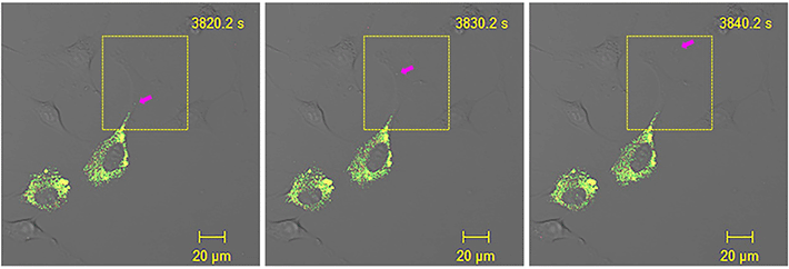図2 皮膚線維芽細胞に可視化I型プロコラーゲンを発現させた様子。黄色＝プロコラーゲン、緑＝コラーゲン。