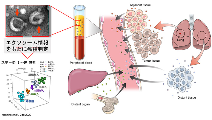 エクソソーム情報をもとにがん種判定