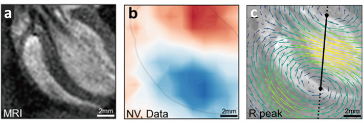 図1. ラット心磁イメージングの結果。（a）ラット心臓のMRI画像。（b）ダイヤモンド量子センサによるミリメートルスケールの心磁画像。（c）心磁画像から予測された心臓の電流密度。(K. Arai et al. Communications Physics)
