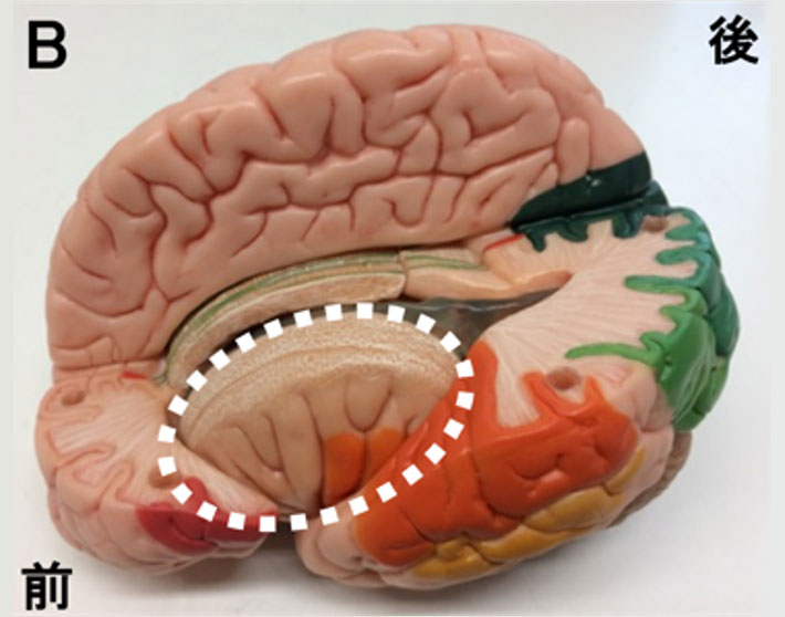 図1 (B)大脳における島皮質の位置
