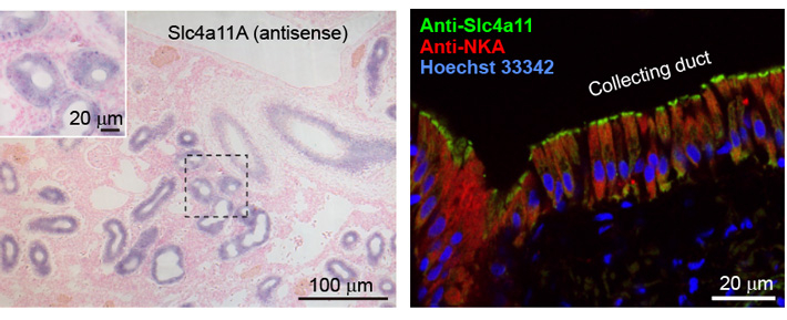 図3 メフグ腎臓におけるSlc4a11Aの発現部位。（左）in situ hybridization法によるメフグ腎臓組織切片におけるSlc4a11Aの発現部位の解析。（右）蛍光免疫法によるメフグ腎臓組織切片におけるSlc4a11Aの発現部位の解析。