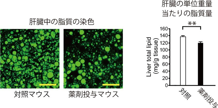 図2 PTPROの働きを抑制する薬剤の投与によって肝臓に蓄積した脂肪が減少した。 