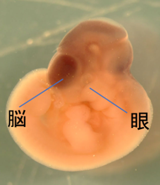 INTS15遺伝子は眼と脳に強く発現している。（In situ hybridization）