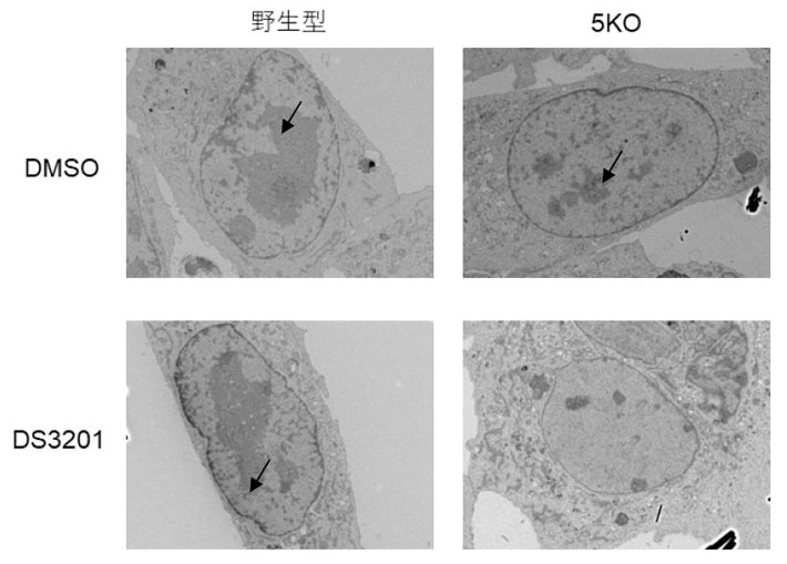 図1 H3K9メチル化とH3K27トリメチル化の欠損によるヘテロクロマチンの消失 野生型細胞にEZH1/EZH2阻害剤DS3201を投与しても、矢印で示されるヘテロクロマチンは維持されているが（左下）、5KO細胞にDS3201を投与すると、一部の細胞でヘテロクロマチンの消失が観察される（右下）。DMSO（ジメチルスルホキシド）は溶媒コントロールとして用いている。