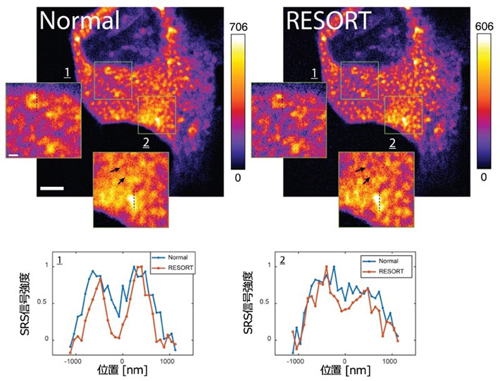 図2 （上）細胞内ミトコンドリアのRESORT画像。（下）画像中の点線部のクロスセクション。 通常のSRS画像（Normal）では分解できなかった構造がRESORTイメージングでは分解されて観察される。