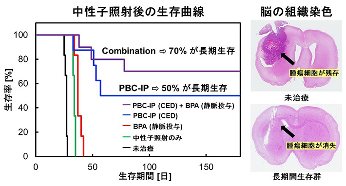図2. （A）PBC-IPをラットグリオーマモデルにCED法で投与し中性子照射を行った後の生存曲線（B）長期生存したラットと未治療ラットの脳組織染色画像