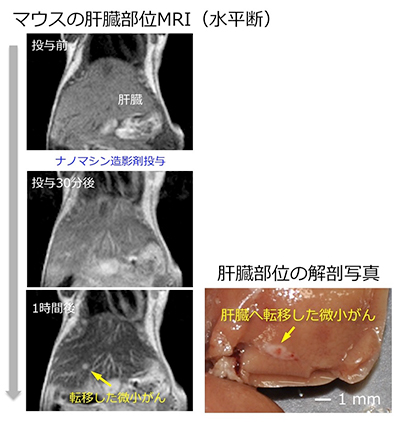 ナノマシン造影剤は、正常な肝臓では信号低下を生じ、肝臓がんでは高信号が得られたため、コントラストが非常に高くなり、肝臓へ転移した1.5 mmの微小な大腸がんを検出することができました。