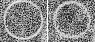 オートファゴソームの連続切片（スライスした断面）。ちょうどよいところで切れた断面（写真左）は、膜がクリアに見える。少しずれると（写真右）、膜がはっきり観察できない。