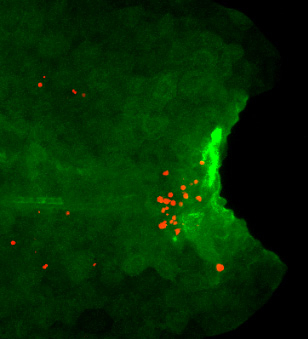 傷害を与えた変異体のゼブラフィッシュ幼生尾部におけるインターロイキン1βの発現（緑色）と細胞死を起こした再生細胞（赤色）