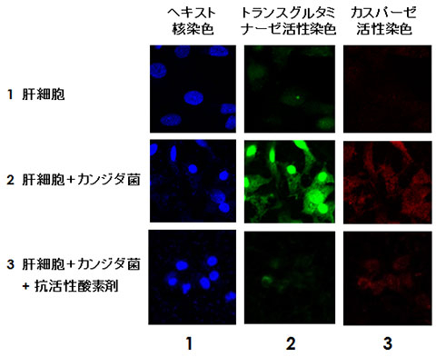 カンジダ菌との共培養による肝細胞中のトランスグルタミナーゼ（TG2）核局在