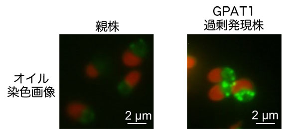 GPAT1過剰発現によるオイル蓄積