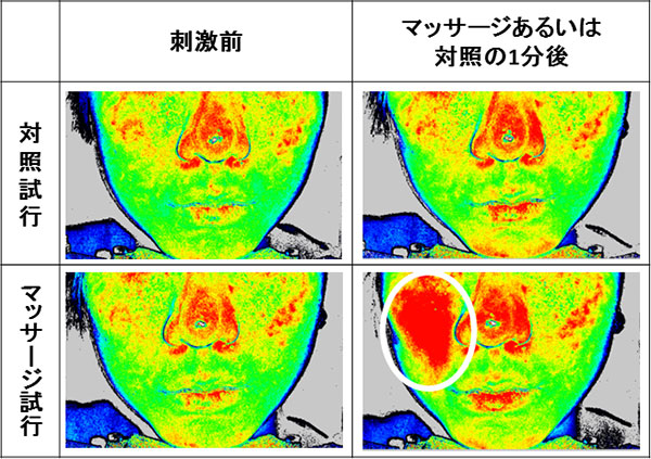 5分間のマッサージ1分後の顔面血流の測定例。刺激前（左列）に比較して、対照試行では血流が変化していない一方、マッサージ試行（右下）では白枠で囲んだ右頬部分の血流が増加していることが分かる（血流が高くなるにつれ、青から緑、赤で表示されている）